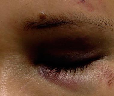 Agredida a socos e pontapés, mulher chega a ser internada em hospital