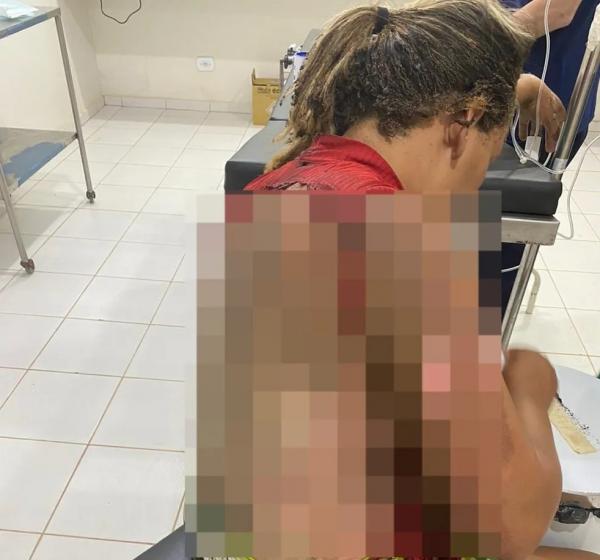 Marido que ateou fogo na companheira enquanto ela dormia tem prisão decretada