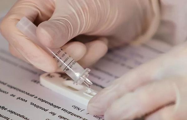 Piauí registra 560 casos confirmados de Covid-19 e 1 morte nas últimas 24 horas