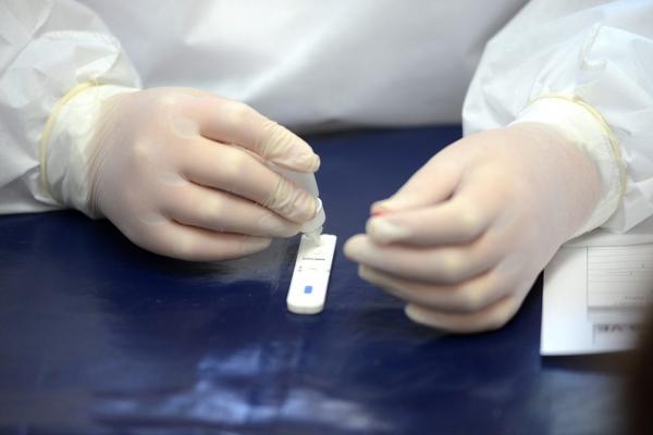 Piauí é o 3° estado do Brasil que mais realizou testes de coronavírus, diz IBGE