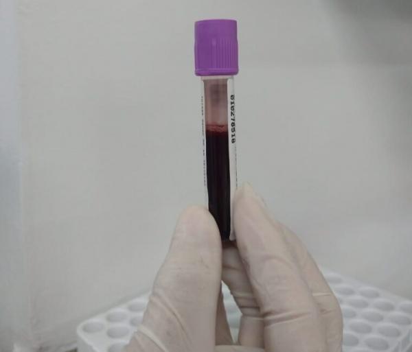 Hemopi realiza cadastro de doadores de medula óssea em 4 municípios piauienses