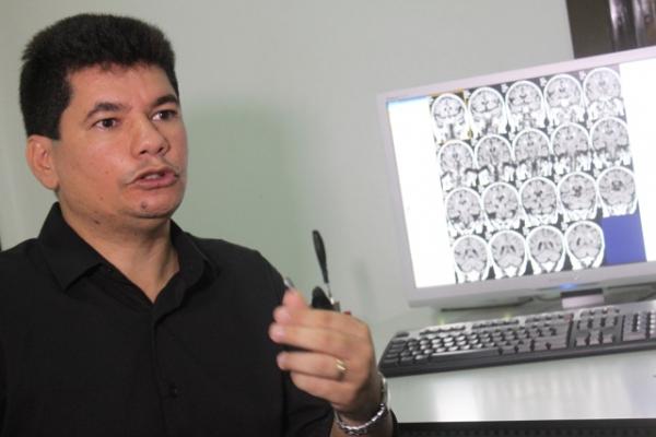 Uespi seleciona voluntários para pesquisa e tratamento sobre TOC