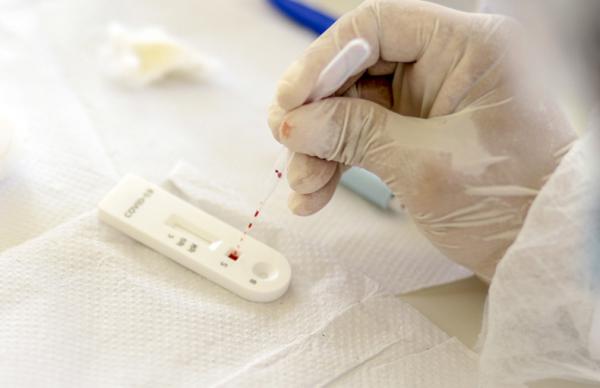 Brasil investiga 2º caso suspeito da ômicron; mulher chegou do Congo e testou positivo