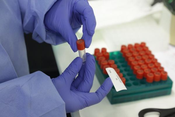 Piauí registra mais sete mortes pela Covid-19 e ultrapassa 5,1 mil casos confirmados