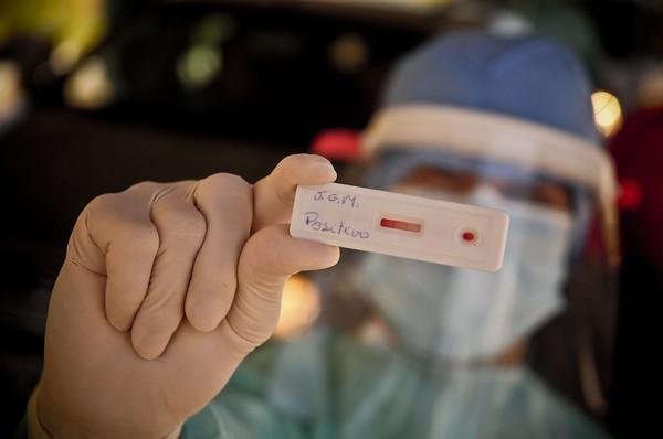 Piauí registra mais de 9 mil casos confirmados de coronavírus e 317 mortes por Covid-19