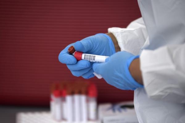 Piauí registra 493 novos casos de Covid-19 e 23 mortes pela doença em 24h