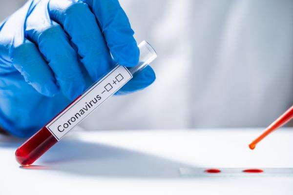 MA bate recorde de casos de coronavírus em 24h e alcança 630 nesta Terça-feira (14)