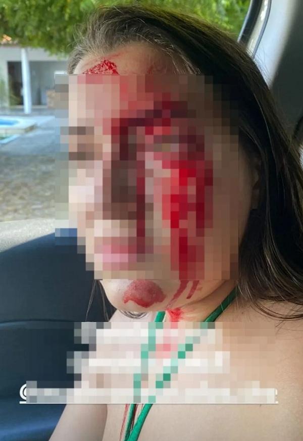 Filho de delegado é denunciado por agressões contra namorada