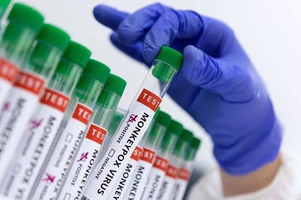 Piauí tem 34 casos confirmados de varíola dos macacos em seis municípios