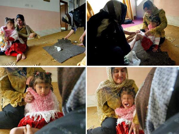Menina de quatro anos &eacute; circuncisada em Sulaimaniyah, no Curdist&atilde;o iraquiano, em abril de 2009 (Imagem:AFP)