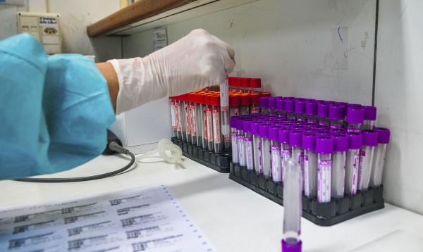 Brasil tem 2,7 milhões de casos e 93,6 mil mortes por covid-19