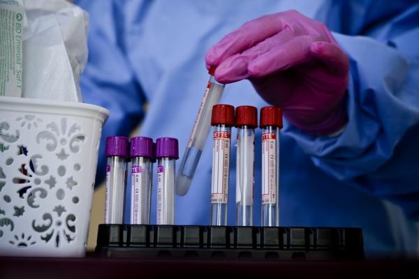 Infectologista defende lockdown por três semanas no Piauí