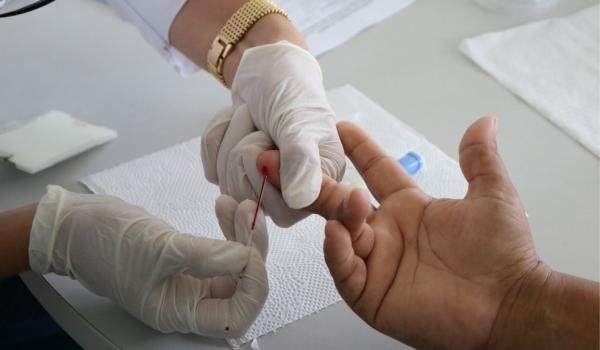 Piauí registra 60 casos confirmados e dois óbitos por Covid-19 nas últimas 24 horas