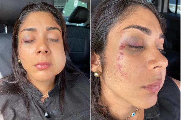 Empres&aacute;ria desmaia ap&oacute;s ser agredida por ex-namorado de amiga com soco no rosto(Imagem:Reprodu&ccedil;&atilde;o)