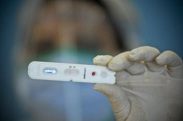 Piauí registra 520 novos casos e nove mortes por Covid-19 nas últimas 24 horas