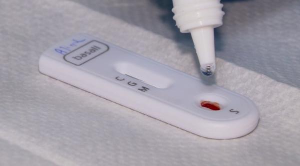 Piauí registra 783 novos casos e seis mortes por Covid-19 nas últimas 24 horas