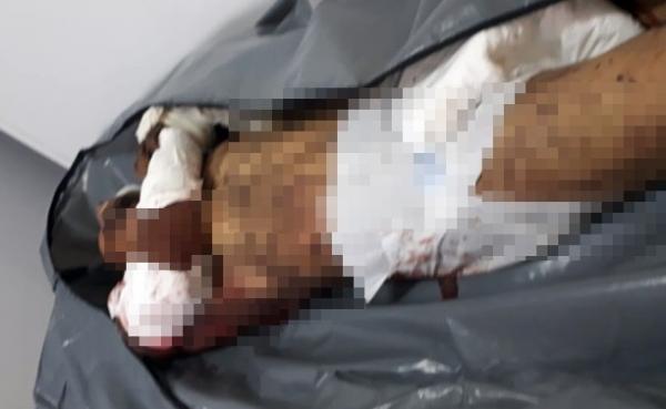 Homem invade casa e morre ao ser atacado por Pitbuls em Coroatá