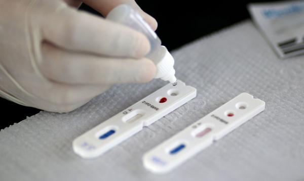 Saiba como funcionam os testes para detectar a covid-19