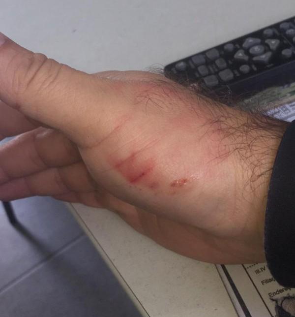 Homem morde policial em Teresina ao ser preso suspeito de tentar atear fogo em estudantes