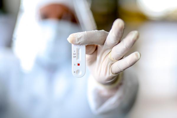 PNAD Covid: Mulher com ensino superior e renda alta é o perfil mais testado no Piauí