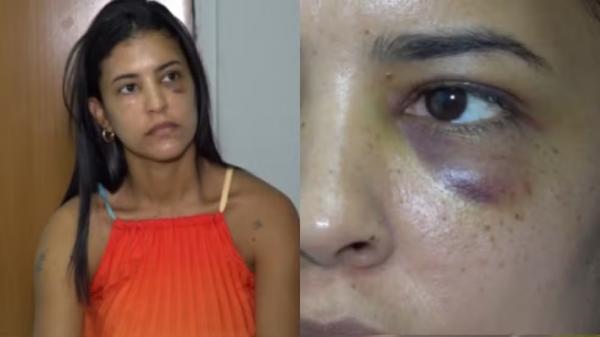 "Me sinto injustiçada", diz secretária que teve casa invadida e foi espancada por ex no PI; suspeito