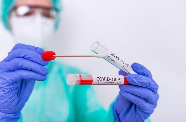 Casos de Covid-19 continuam em queda no Piauí e média móvel de mortes se mantém em estabilidade