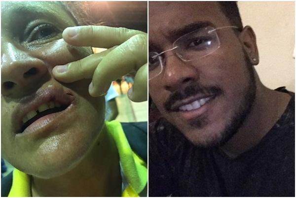 Estudante que agrediu árbitra se entrega à polícia.(Imagem:Portalr10)