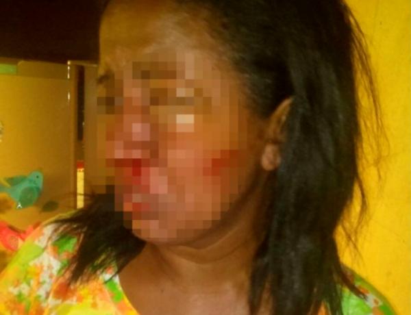Vice-prefeito presta depoimento na delegacia da mulher sobre agressão à irmã