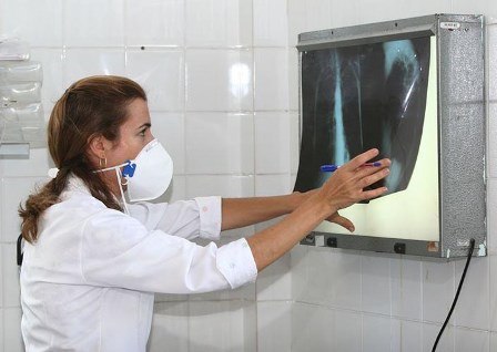 Tuberculose mata 4.500 pessoas todos os dias no mundo