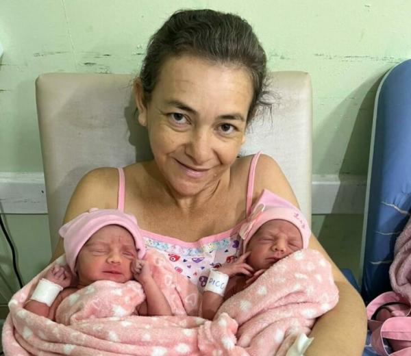 Paciente da Nova Maternidade Evangelina Rosa dá à luz gêmeas em gestação extremamente rara