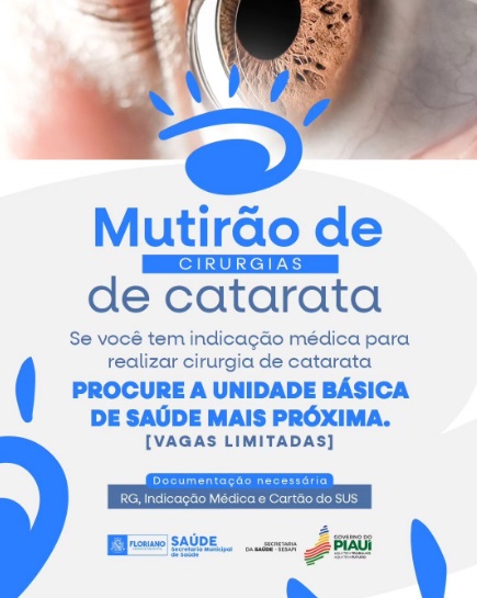 Mutirão de cirurgias de catarata em Floriano entra na fase de triagem