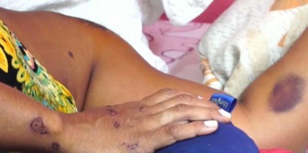 Elisabeth Pereira ficou ferida no acidente.(Imagem:Reprodu&ccedil;&atilde;o)