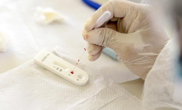 Piauí registra queda de 83% nas mortes por Covid-19, diz Sesapi