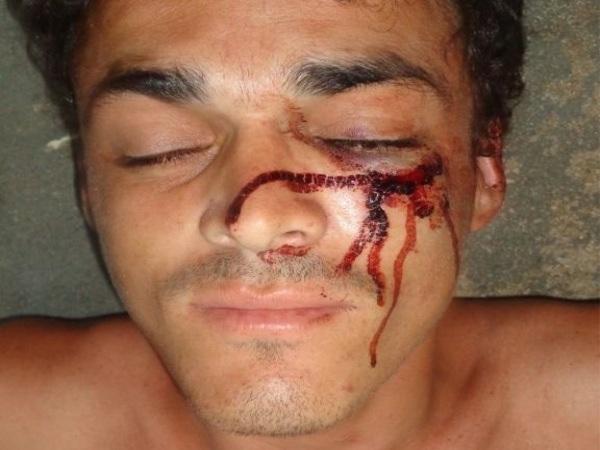 Homem &eacute; preso ap&oacute;s tentar assaltar motel e acabar levando surra.(Imagem:Portal do Catita)