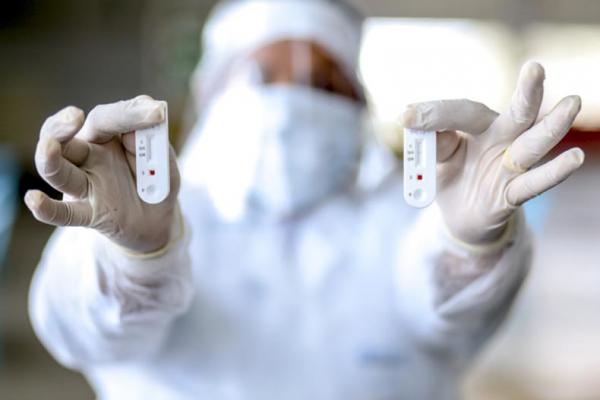 Brasil já registra 6 casos da variante ômicron; RS confirma primeiro caso