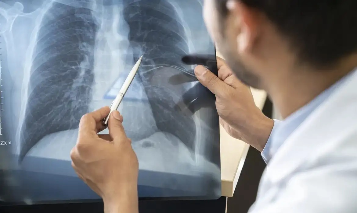 Anvisa aprova novo medicamento para câncer de pulmão avançado
