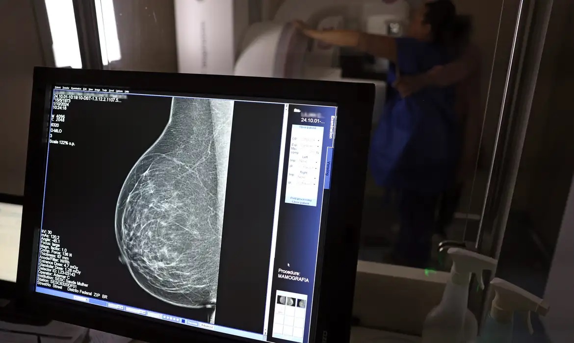 Médicos lançam guia para evitar recusa de mamografia digital
