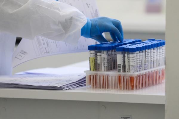 Piauí chega a quase 60 mil infectados pelo coronavírus; 2 cidades não registraram casos
