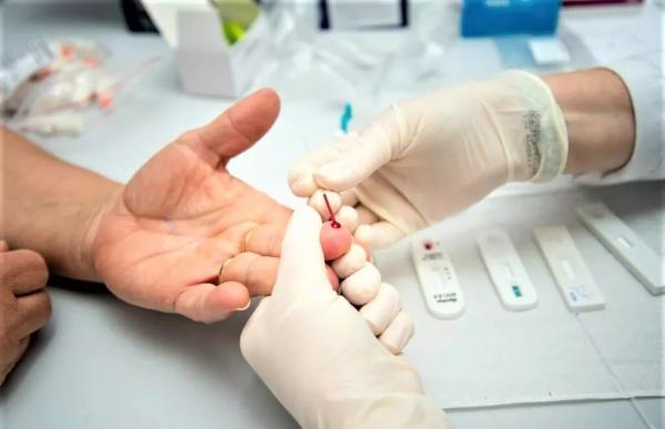 Piauí registra 582 casos confirmados e um óbito por Covid-19 nas últimas 24 horas