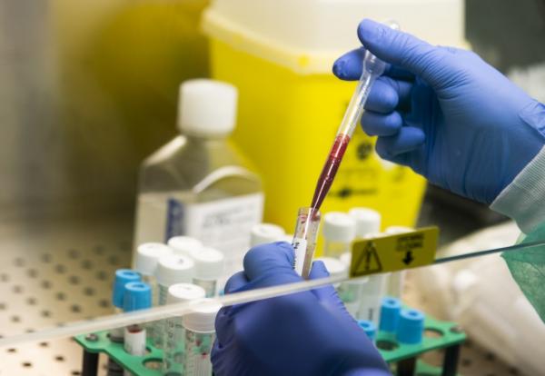 Sesapi confirma mais quatro óbitos pela Covid-19; PI chega a 161 mortes e a 4.931 casos confirmados
