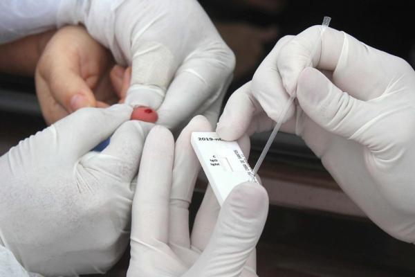 Piauí ultrapassa seis mil casos confirmados e mais de 200 mortes causadas pelo novo coronavírus