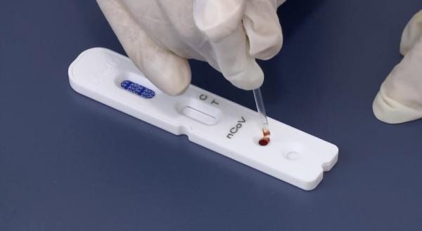 Casos positivos de Covid-19 dobram em Teresina nos Centros de Testagem