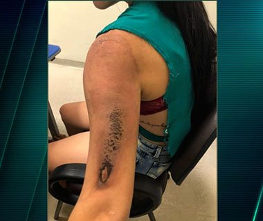 Boate em que estudante de Direito sofreu queimaduras é multada em quase R$ 6 mil