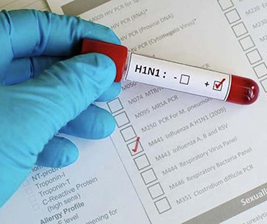 Fundação Municipal de Saúde confirma 1ª morte por H1N1