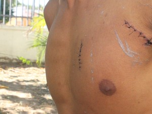 "Não usei ela como escudo", diz pai de bebê esfaqueada durante briga no PI