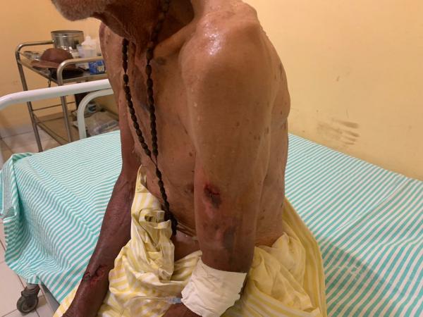 Idoso de 77 anos é sequestrado e torturado durante 9 horas no Sul do Piauí