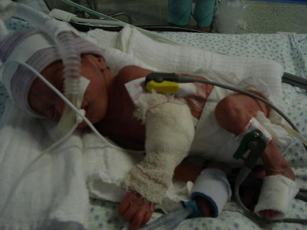 Bebê de 16 dias é espancado em Várzea Grande