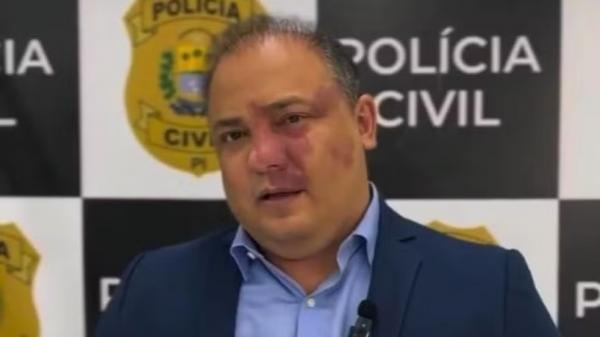 Delegado-geral explica o que levou SSP a decidir fechar delegacia de proteção ao menor