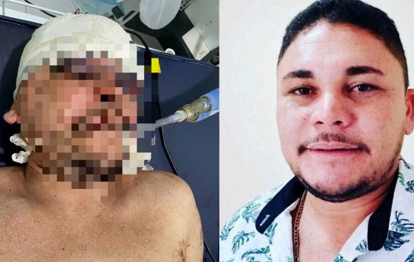 Ex-candidato a prefeito encontrado baleado com dez tiros morre após vários dias internado