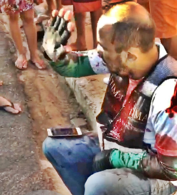 Mototaxista é alvejado com três tiros em tentativa de homicídio no PI